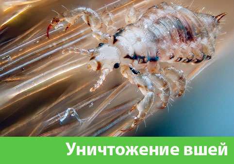 Уничтожение вшей в городе Бузулук